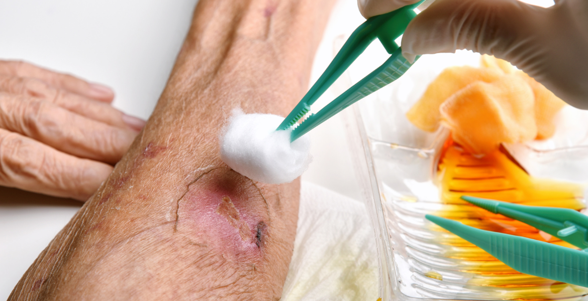 Complex Wound Management Training for NDIS Workers